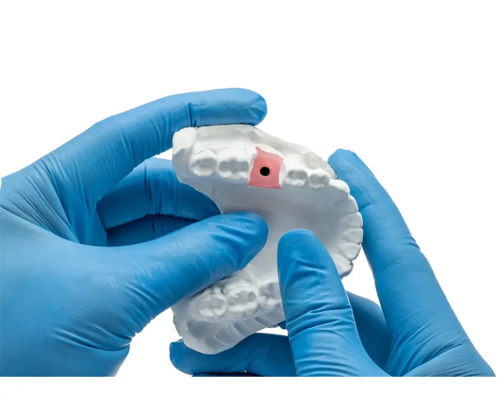 A-Silikon für Zahnfleisch maske
