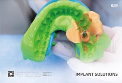 RIESIGE Implantat lösung