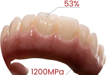 Ganzkiefer bereit. Ästhetik inklusive. Sehen Sie MM-4D Zirkonia in echten klinischen Fällen.