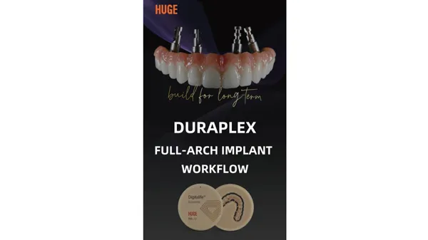 Kompletter Implantat-Workflow für den vollständigen Bogen mit DuraPlex PMMA & Gumimic