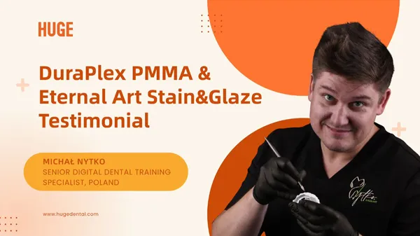 Warum der polnische Top-KOL Michał Nytko sich bei DTS UK für den HUGE Dental Workflow entscheidet!